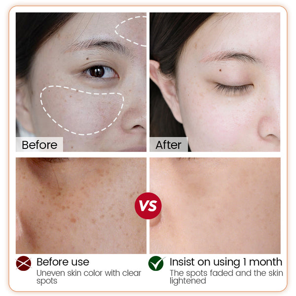 VIBRANT GLAMOUR α-Arbutin Whitening Serum Niacinamide Reduce Dark Spots 30ml