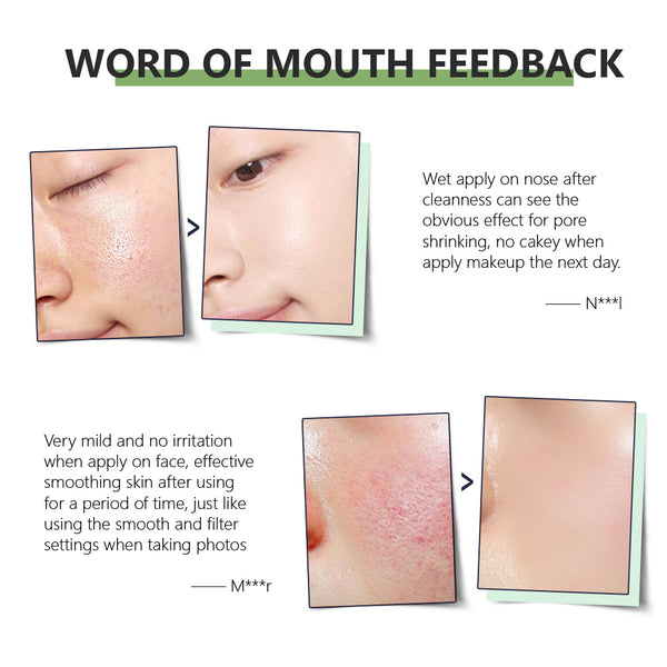 VIBRANT GLAMOUR Herbal Pore Minimizer Serum Deep Cleansing 15ml