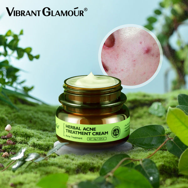 VIBRANT GLAMOUR Herbal Acne Treatment Cream 30g
