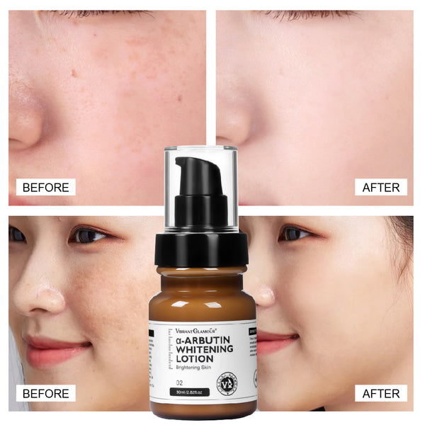 VIBRANT GLAMOUR α-Arbutin Whitening Lotion Niacinamide Reduce Freckles 80ml