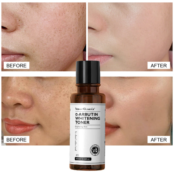VIBRANT GLAMOUR α-Arbutin Whitening Sets Face Cleanser+ Toner+Lotion Niacinamide 3pcs
